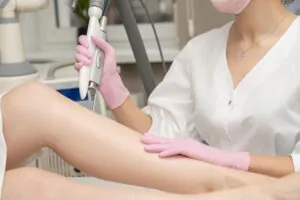 Fundo ambulatorial com me´dica fazendo tratamento com laser em perna com varizes
